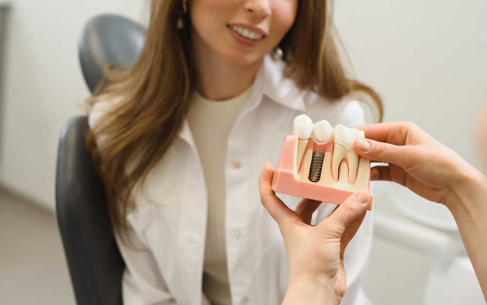 Conoce cómo cuidar correctamente tus implantes dentales